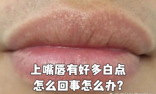 长痘期间可以用护肤品吗-起痘期间能抹粉底吗网起痘期间能抹粉底吗知识网站,分享长痘痘能不能用粉底液大全